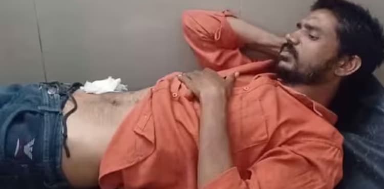 Man performs self-surgery after watching YouTube videos