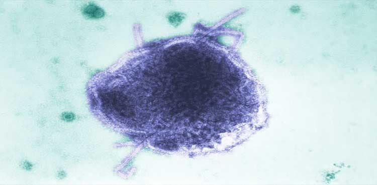 LA County reports child died from rare measles complication after infection in infancy
