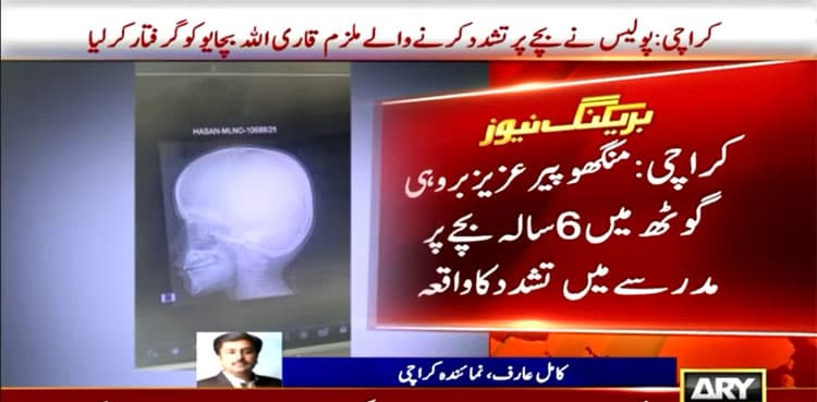 Qari arrested in Karachi for allegedly torturing 6-Year-Old, causing skull fracture