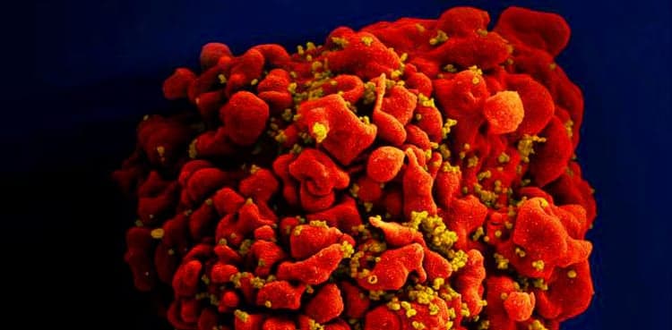 Small study shows one-time cell therapy can control HIV infection
