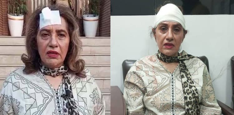 Uzma Kardar severely injured during gym workout