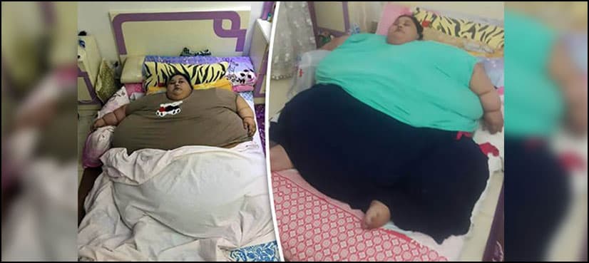 'World's heaviest woman' to fly to India for surgery