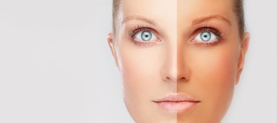 WATCH: Home remedy to get a fairer skin