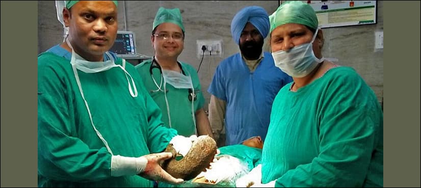 Operation eases teenager’s life who had 2kg hairball in her stomach