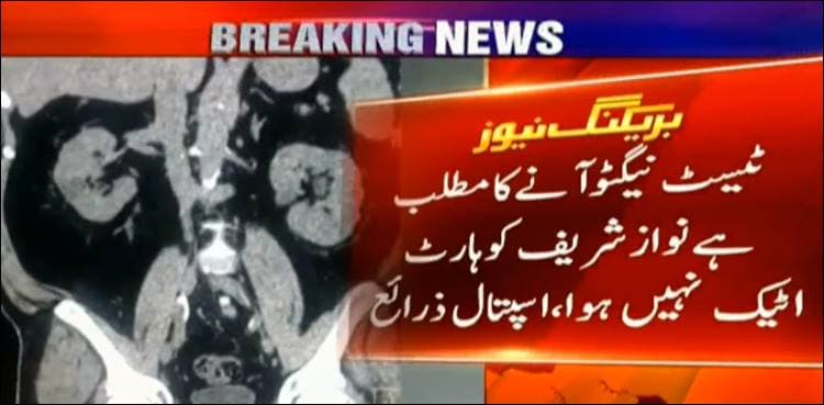 Test report shows Sharif did not suffer a cardiac stroke: sources