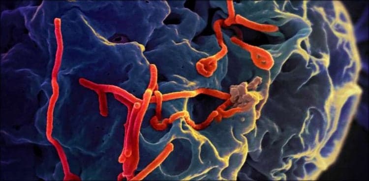 Ebola virus likely to spread into Pakistan from South Africa