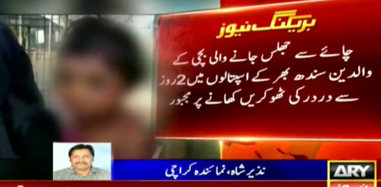 Hospitals reject providing treatment to minor girl sustained burn injuries