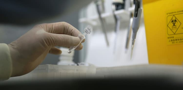 Pakistan lacks facility to detect coronavirus