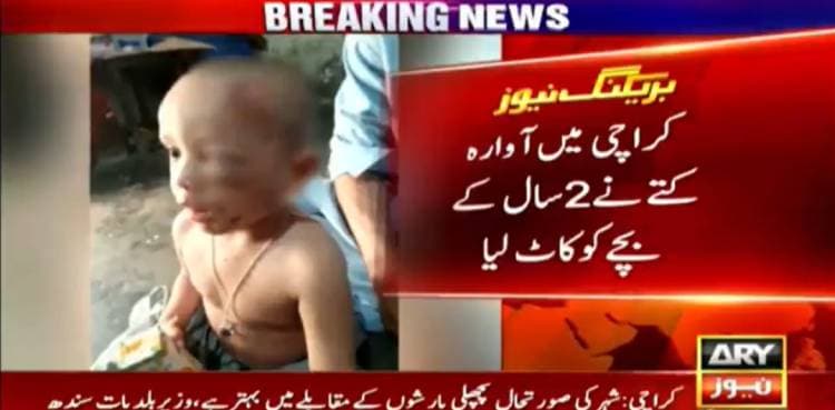 Dog attack severely injures child in Karachi as father pleads for treatment