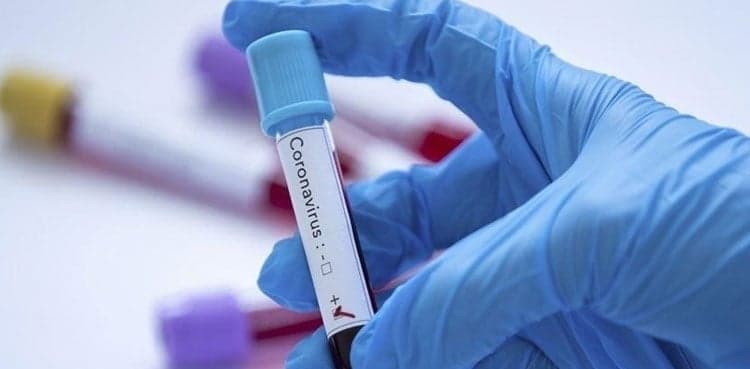 Islamabad sees highest Covid positivity rate