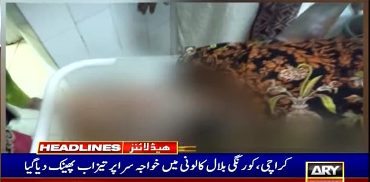 TW: Horrific acid attack on Karachi transgender causes 60pc body burns