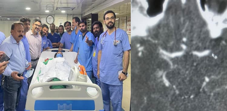 In a first, NICVD treats patient suffering from paralysis stroke