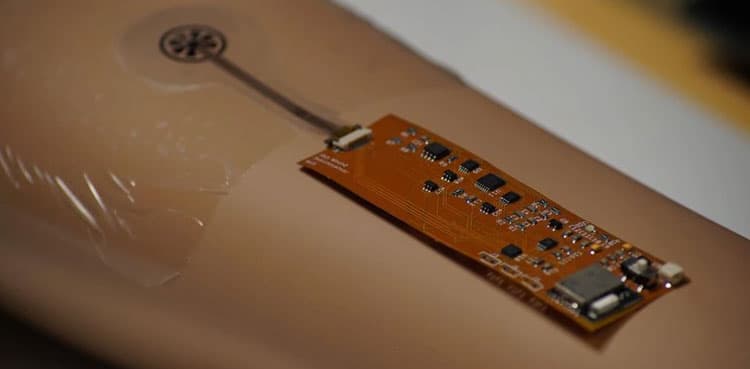 Singapore: 'Smart bandage' to enable patients to monitor wounds via app
