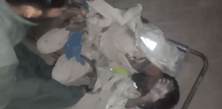 Hyderabad Civil Hospital doctors 'refuse' treatment to patient over foul odor