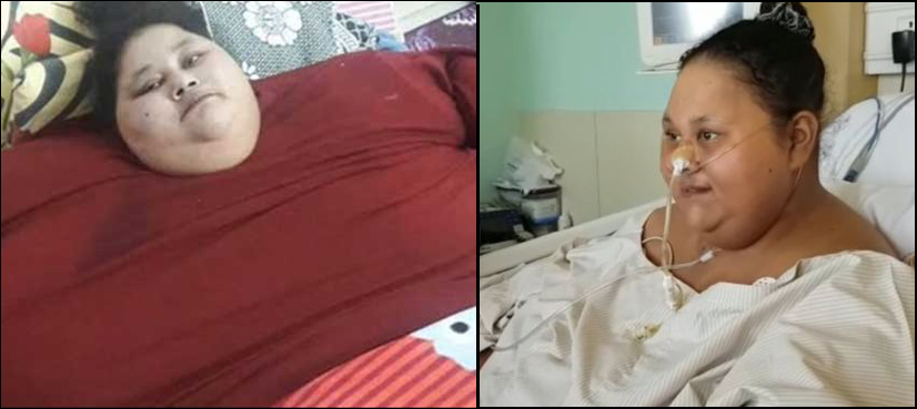 500kg Egyptian woman sheds half her weight after surgery - ARY NEWS