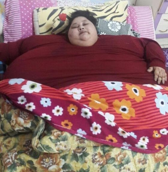 500kg Egyptian woman sheds half her weight after surgery - ARY NEWS