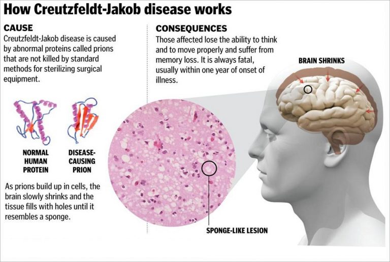 how-likely-are-you-to-get-mad-cow-disease-today-videos