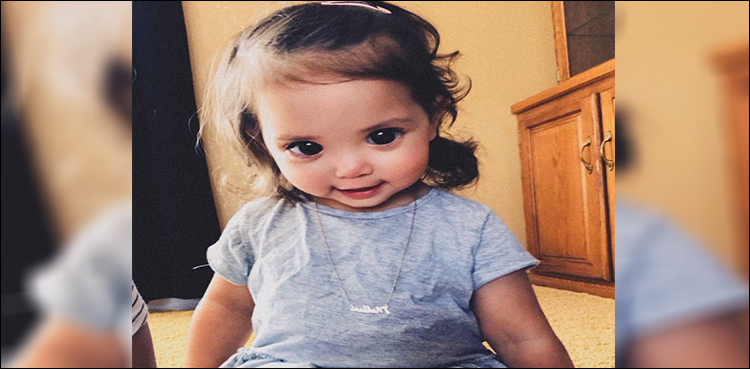 Rare condition gives baby girl Disney Princess-like eyes