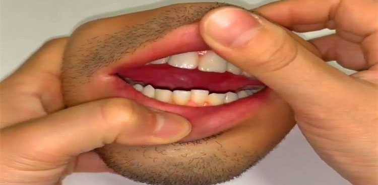 Human Mouth Purse Gets Jaw Dropping Reactions