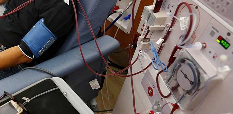 Bloodless Dialysis Machine