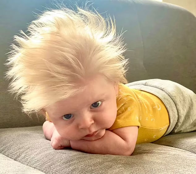 Baby Born With Full Head Of Blond Hair Looks Like Mini Boris Johnson
