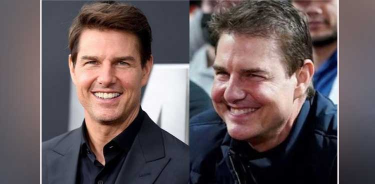 Tom Cruise fans left surprise after facial surgery