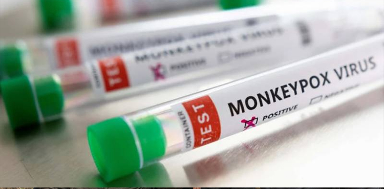 Spain reports second monkeypox death