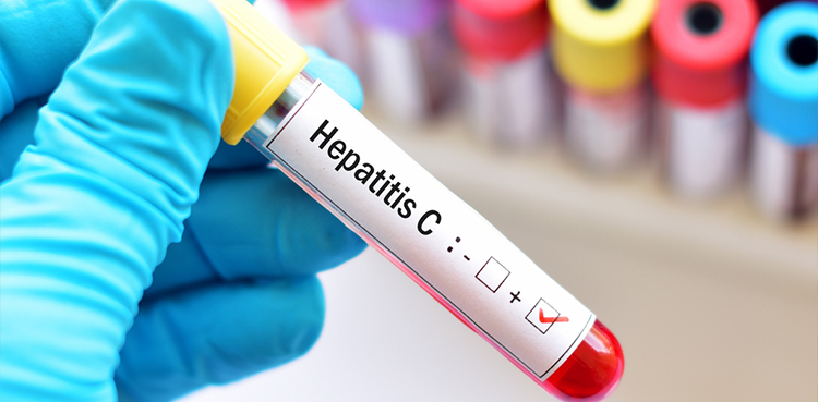 hepatitis C, US, life-saving care