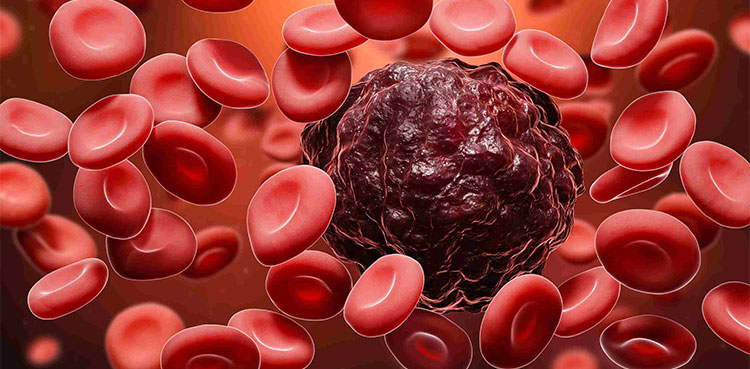 Imetelstat: Blood cancer drug