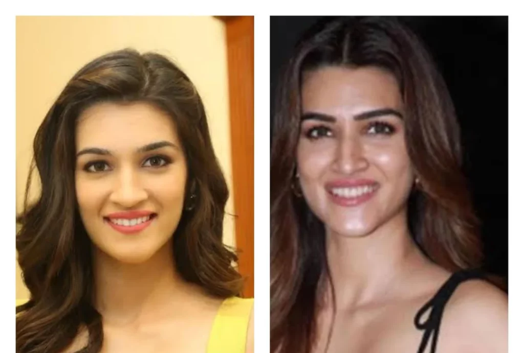 kriti sanon nose job