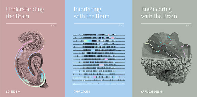 Neuralink Brain Implant