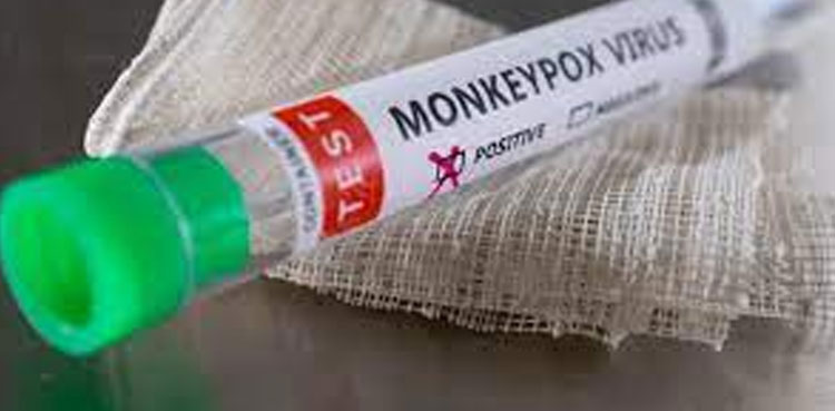 Another, Monkeypox case, reported, Karachi Airport