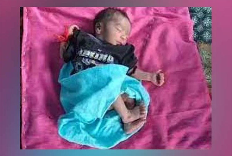 Baby born with 26 fingers in India