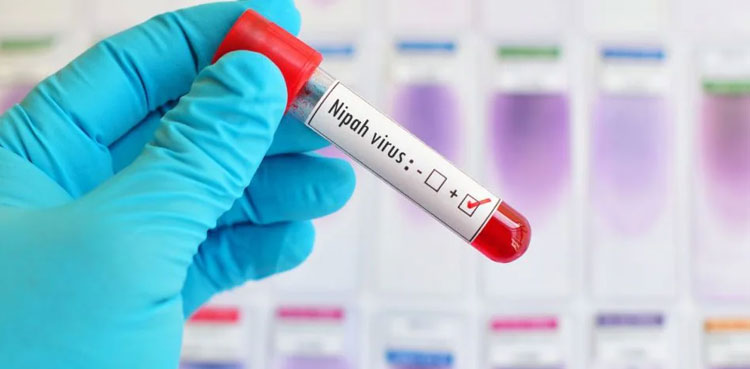Nipah virus, NIH, NIH advisory